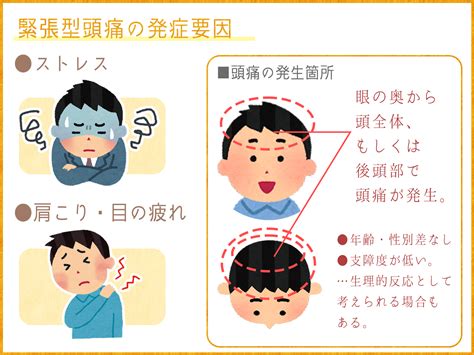 頭痛|頭痛の種類まとめ～それぞれの違いと原因、症状、治。